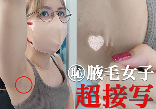 【腋毛超接写】金髪眼鏡ギャルのひょろ長腋毛と大胆行為を超接写